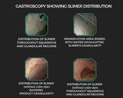 Inforgraphic gastroscopy showing the benefit of Equine Elixirs Slimer